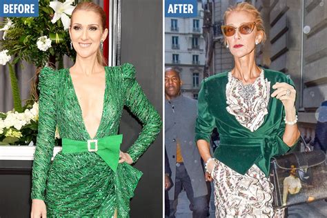 celine before and after|where is Celine dion now.